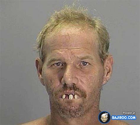 Funny Teeth Weird Pics Images Free Bad Funny Teeth People