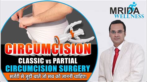 Circumcision Surgery Classic Vs Partial Circumcision सर्जरी से जुड़ी बातें जो सब को जाननी चाहिए