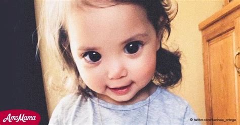 Niña Con Rara Condición Genética Se Vuelve Sensación En Internet Por Sus Ojos De Muñeca