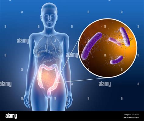 Clostridium Difficile Colitis Fotografías E Imágenes De Alta Resolución