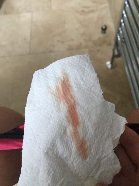 If the discharge during pregnancy is dark pink or red in color, it could be a symptom of a serious problem and so immediate medical assistance is necessary. ( picture attached ) Pink bleeding 6 days after my period ...
