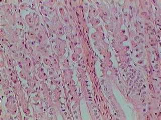 Stomach Histology Stomach Histology Slide