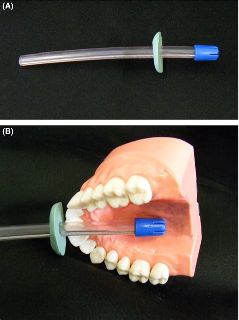 Gag Reflex Test