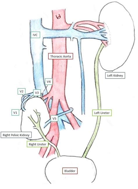 Schematic Diagram Of Kidneys And Vasculature V1 V5 Renal Veins