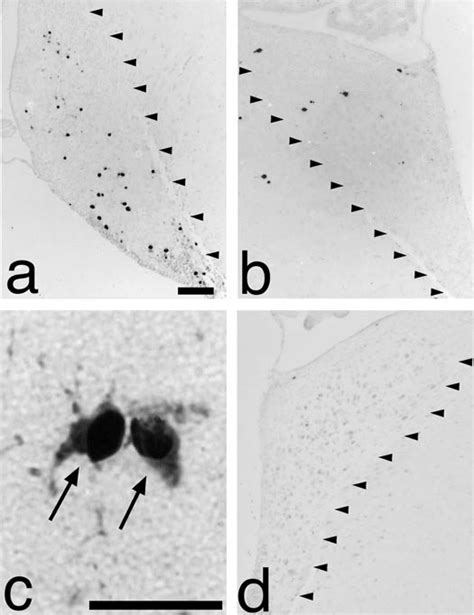 Detection Of Activated Caspase 3 In The Avcn After Cochlea Removal A
