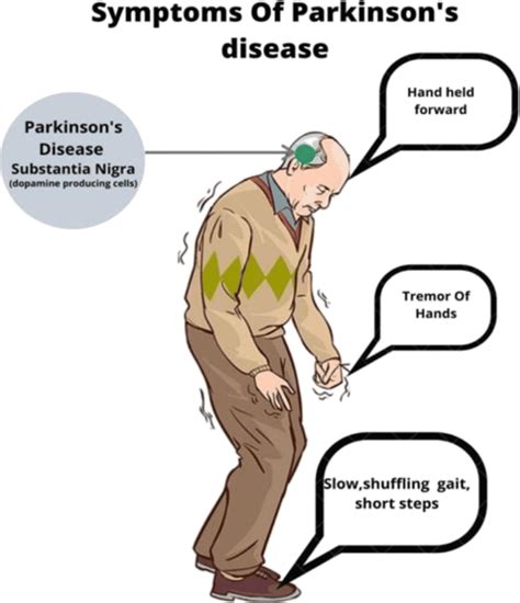 Symptoms Of Parkinson’s Disease Download Scientific Diagram
