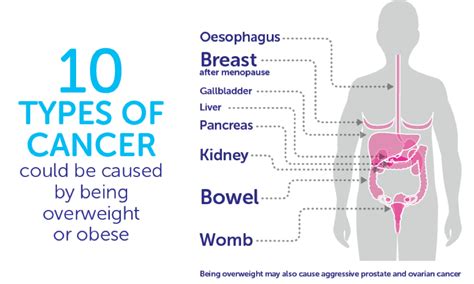 Obesity Increases Pancreatic Cancer Risk Pancreatic Cancer Awareness