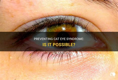 Preventing Cat Eye Syndrome Is It Possible Petshun