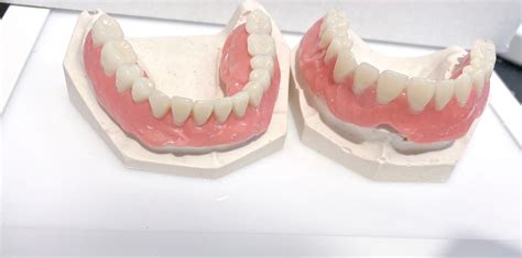 Make Your Own Denture Kit Acrylic Resin False Teeth Full Set Etsy