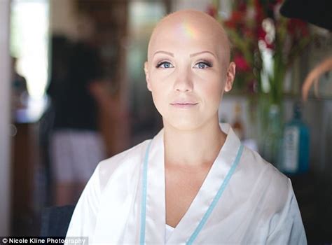 Bride With Alopecia Goes Bald On Her Wedding Day Daily Mail Online