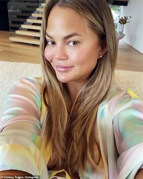 Chrissy Teigen Denies Getting Filler In Her Cheeks After Buccal Fat Removal