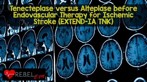 Tenecteplase Versus Alteplase Before Endovascular Therapy For Ischemic
