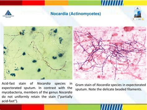 Ppt Nocardia And An Aerobic Bacteria Powerpoint Presentation Free