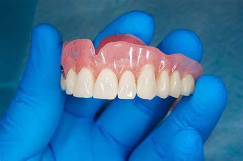 Closeup Human Denture Of The Upper Jaw On A Blue Background In The Hand
