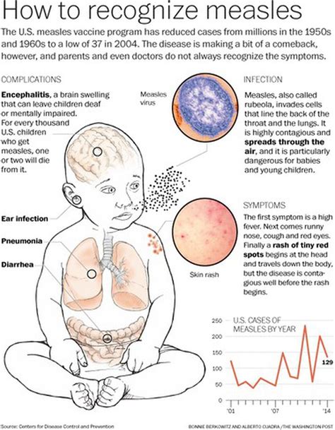 Measles Is Making A Comeback Heres What Parents Need To Know