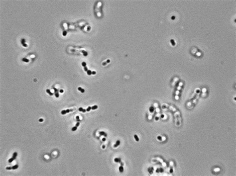 Yeast Cells Under Microscope 400x Micropedia