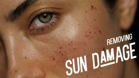 Sunspots On Face Treatment