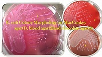 Escherichia coli Colony Morphology on Macconkey agar, blood agar and ...