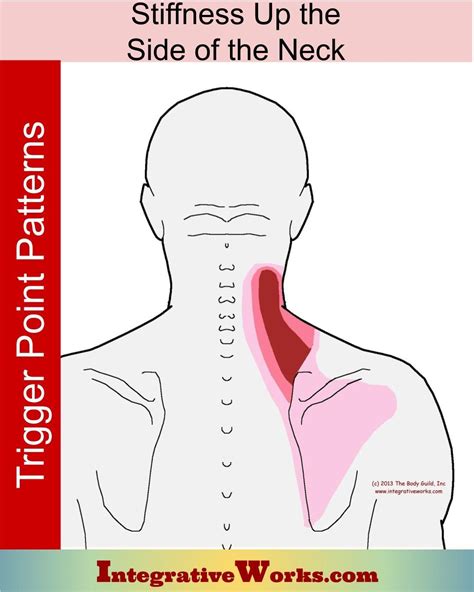 Pin On Neck Trigger Point Pain