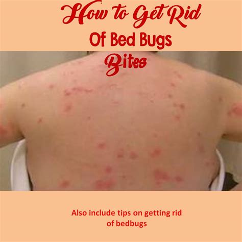 Infected Bed Bug Bites