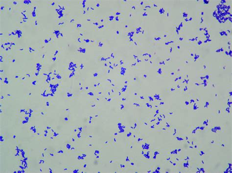 Gram Positive Bacilli Were Isolated From Blood On The 26 Th Hospital