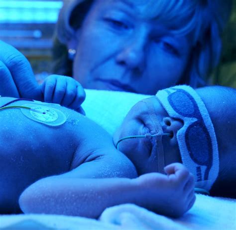 Dass er zusammen mit mona. Gesundheit: Gelbsucht bei Babys kann zu Autismus führen - WELT