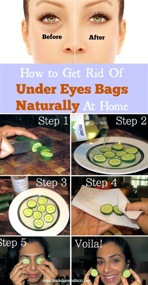 How To Get Rid Of Under Eyes Bags And Reduce Puffy Eyes Naturally At Home With Cucumbers Rose