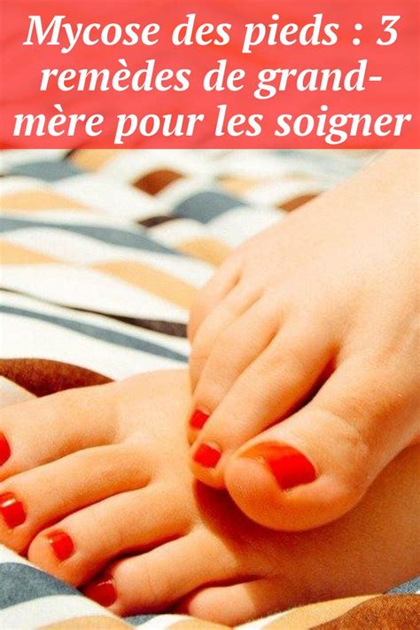 Mycose Des Pieds Rem Des De Grand M Re Pour Les Soigner En Hot Sex Picture