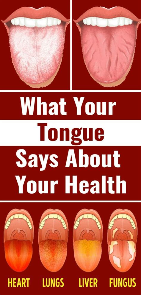 What Your Tongue Says About Your Health Tongue Health Health Health