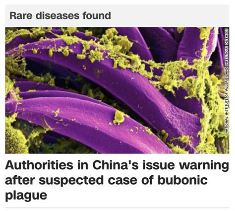 Bubonic Plague Case Suspected In China Sunday July 5 2020 Gematria