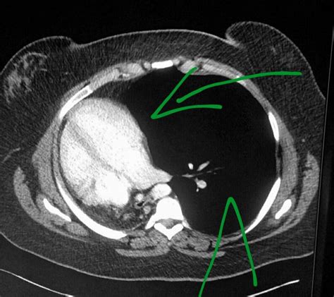 Pin On Ct Scans