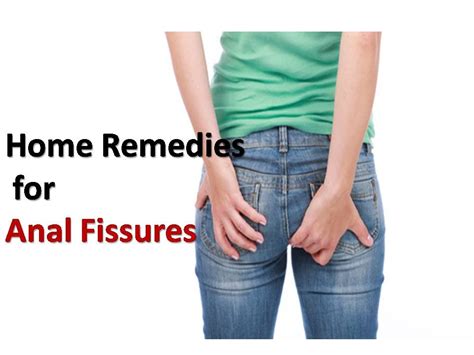 Best Home Remedies For Anal Fissures Yabibo