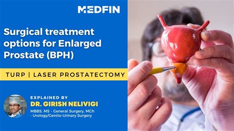 Enlarged Prostate Treatments Turp Best Surgical Treatment For Bph Enlarged Prostate Youtube