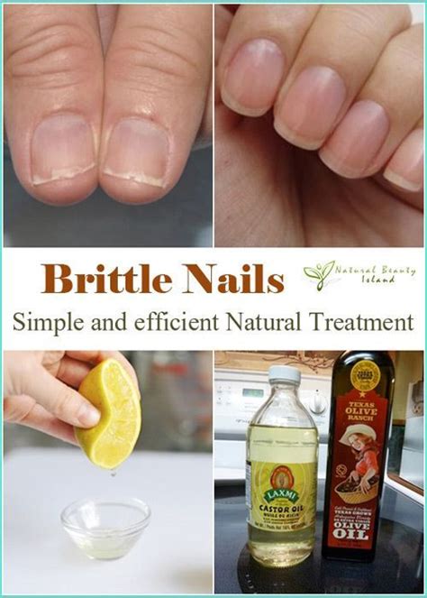 Homemade Natural Remedies For Long And Strong Nails How To Grow Nails