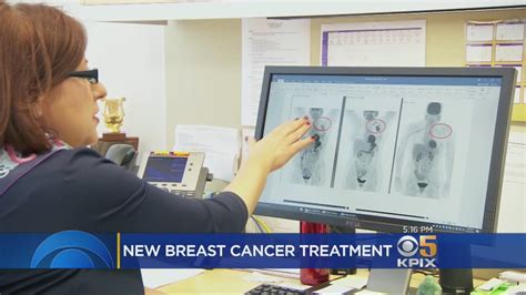 New Treatment Shows Promise For Triple Negative Breast Cancer Patients