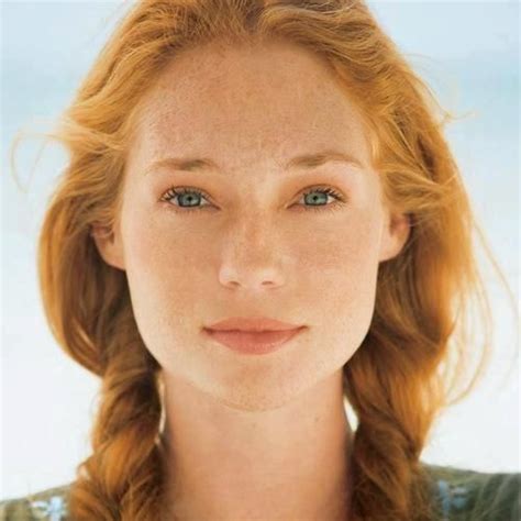 Exploring The Unique Shades Of Irish Skin How Freckles Affect Warm And