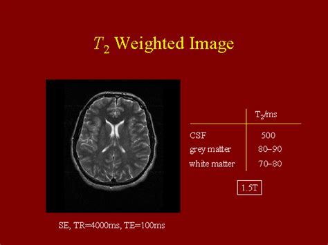 T2 Weighted Image