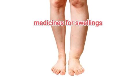 5 Medicines That Help Relieve Swelling Us Times Now