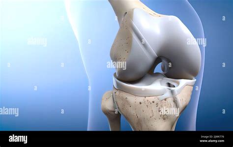 Anterior Knee Ligament Sports Injury Hi Res Stock Photography And