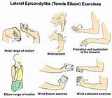Exercises For Tennis Elbow Pictures