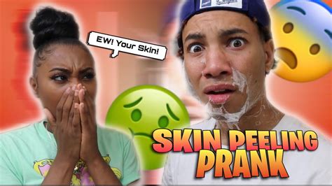 Disgusting Skin Peeling Prank On Girlfriend She Freaked Out Youtube