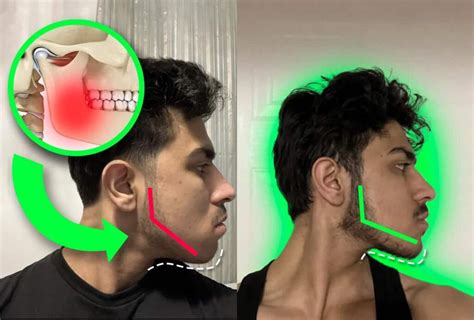 How To Get A Better Jawline Exercises And Tips Mewing Coach