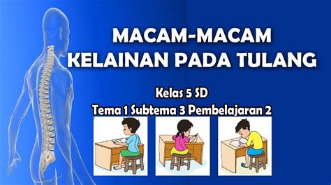 Kelainan Pada Tulang Newstempo