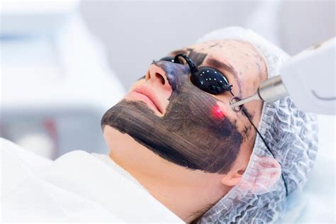 Peeling Hollywood - Tratamentos faciais de rejuvenescimento SmartLIPO
