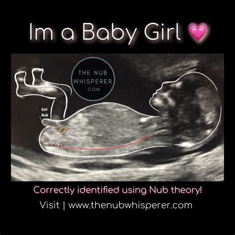 Nub Theory Gender Prediction Boy Ultrasound Pictures Baby Gender