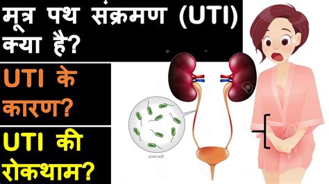 Urinary Tract Infection Uti Overview Symptoms Causes And