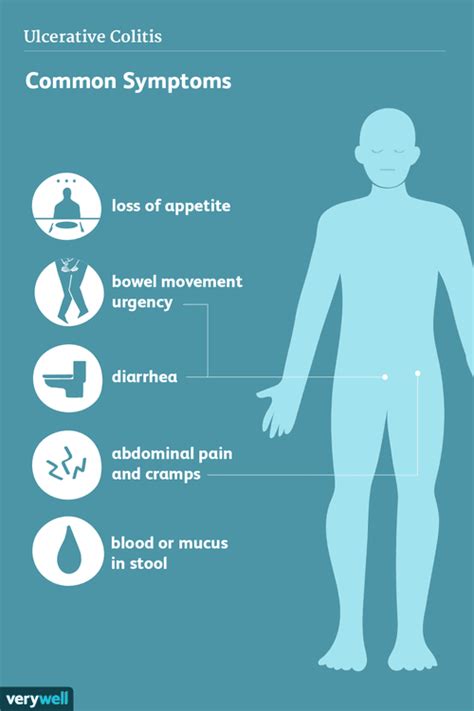 Ulcerative Colitis Signs Symptoms And Complications