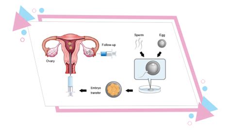 In Vitro Fertilization And Embryo Transfer Cfc