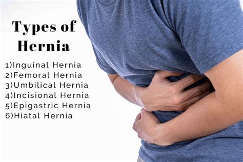 Common Types Of Hernias That May Cause You Pain Dr Abhijit Gotkhinde Ultracare Clinic Pune