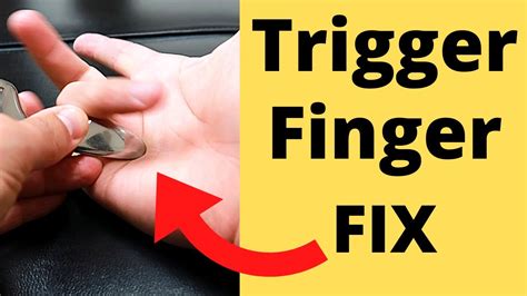 fix trigger finger in 5 minutes 3 steps youtube